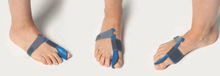 Load image into Gallery viewer, 腳拇指外翻矯正器-睡覺時使用 Night-time bunion corrector CC250