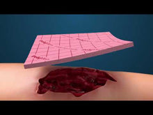 Load and play video in Gallery viewer, 多功能空腔傷口填充物(細片型) PolyMem WIC Cavity wound filler
